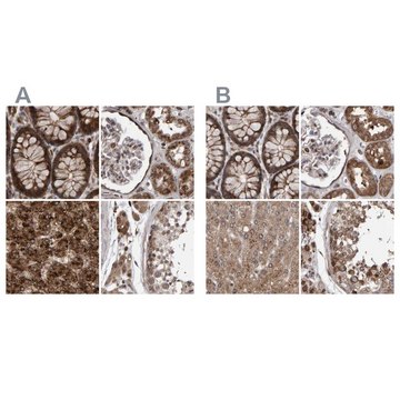 Anti-PECR antibody produced in rabbit Prestige Antibodies&#174; Powered by Atlas Antibodies, affinity isolated antibody, buffered aqueous glycerol solution, Ab1