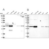 Anti-GPATCH11 antibody produced in rabbit Prestige Antibodies® Powered by Atlas Antibodies, affinity isolated antibody, buffered aqueous glycerol solution