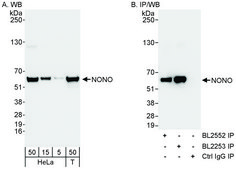 Rabbit anti-NONO Antibody, Affinity Purified Powered by Bethyl Laboratories, Inc.