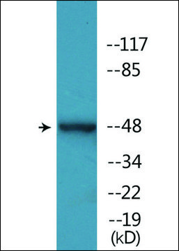 Anti-phospho-YAP (pSer127) antibody produced in rabbit affinity isolated antibody