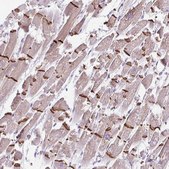 Anti-DSP antibody produced in rabbit Prestige Antibodies® Powered by Atlas Antibodies, affinity isolated antibody, buffered aqueous glycerol solution