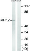 Anti-RIPK2 antibody produced in rabbit affinity isolated antibody