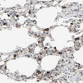 Anti-ZNF608 antibody produced in rabbit Prestige Antibodies® Powered by Atlas Antibodies, affinity isolated antibody, buffered aqueous glycerol solution