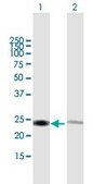 Anti-RPL14 antibody produced in mouse purified immunoglobulin, buffered aqueous solution