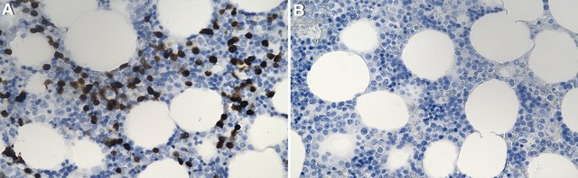 Anti-S100A12 Antibody, clone 1L6 ZooMAb&#174; Rabbit Monoclonal recombinant, expressed in HEK 293 cells