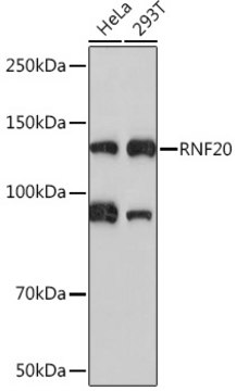 Anti-RNF20 Antibody, clone 8N4O8, Rabbit Monoclonal