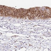 Anti-ANXA10 antibody produced in rabbit Prestige Antibodies® Powered by Atlas Antibodies, affinity isolated antibody, buffered aqueous glycerol solution