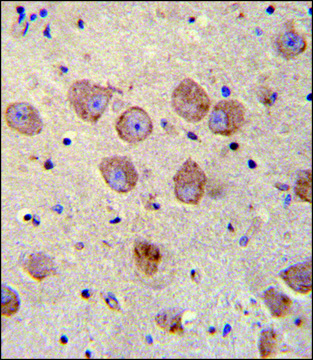 ANTI-FUSSEL18 (C-TERM) antibody produced in rabbit IgG fraction of antiserum, buffered aqueous solution