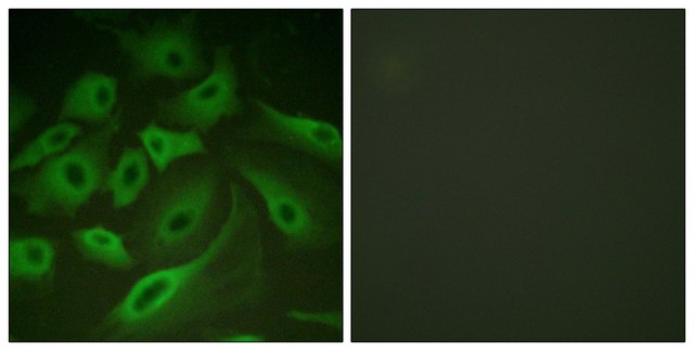 Anti-PLB antibody produced in rabbit affinity isolated antibody