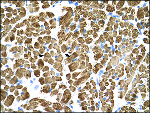 Anti-TPM2 antibody produced in rabbit IgG fraction of antiserum