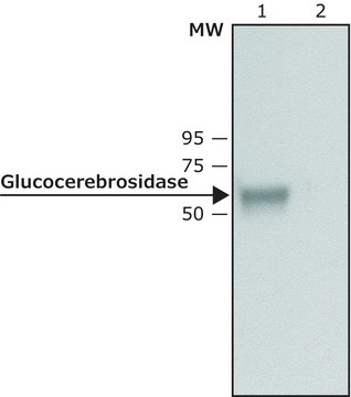 Anti-Glucocerebrosidase 兔抗 ~1&#160;mg/mL, affinity isolated antibody, buffered aqueous solution