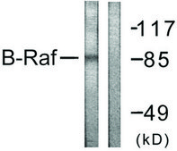 Anti-B-RAF, C-Terminal antibody produced in rabbit affinity isolated antibody