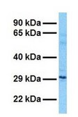 Anti-RPL13 antibody produced in rabbit affinity isolated antibody