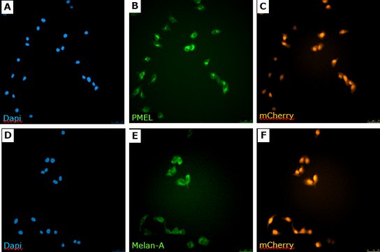 sLT-RMS Spontaneous Lung-tropic RET Melanoma-sorted Mouse Cell Line