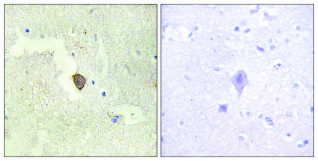 Anti-ADCY7 antibody produced in rabbit affinity isolated antibody