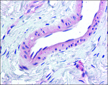 Anti-KCNMA1 antibody produced in rabbit affinity isolated antibody