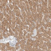 Anti-ALDH7A1 antibody produced in rabbit Prestige Antibodies® Powered by Atlas Antibodies, affinity isolated antibody, buffered aqueous glycerol solution