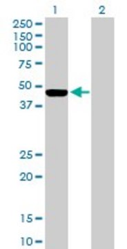 Anti-ILKAP antibody produced in mouse purified immunoglobulin, buffered aqueous solution