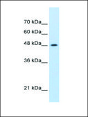 Anti-SMARCE1 antibody produced in rabbit affinity isolated antibody