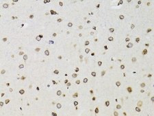 Anti-TMPO antibody produced in rabbit