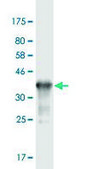 Monoclonal Anti-RAB3B, (C-terminal) antibody produced in mouse clone 1A7, purified immunoglobulin, buffered aqueous solution