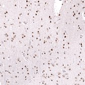 Monoclonal Anti-Foxo3 Antibody Produced In Mouse Prestige Antibodies® Powered by Atlas Antibodies, clone CL13603, affinity isolated antibody, buffered aqueous glycerol solution