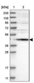 Anti-SCRN2 antibody produced in rabbit Prestige Antibodies® Powered by Atlas Antibodies, affinity isolated antibody, buffered aqueous glycerol solution, Ab2