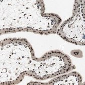 Anti-ETV4 antibody produced in rabbit Prestige Antibodies® Powered by Atlas Antibodies, affinity isolated antibody, buffered aqueous glycerol solution