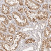 Anti-ADAMTS9 antibody produced in rabbit Prestige Antibodies® Powered by Atlas Antibodies, affinity isolated antibody, buffered aqueous glycerol solution, ab2