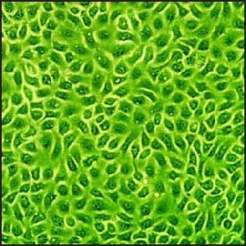 Bovine Endometrial Epithelial Cells: BEnEpC (Cryovial)