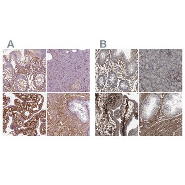 Anti-COL6A2 antibody produced in rabbit Prestige Antibodies&#174; Powered by Atlas Antibodies, affinity isolated antibody