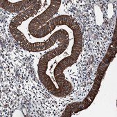 Anti-WHAMM antibody produced in rabbit Prestige Antibodies® Powered by Atlas Antibodies, affinity isolated antibody, buffered aqueous glycerol solution