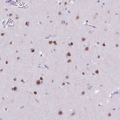 Monoclonal Anti-SATB2 antibody produced in mouse Prestige Antibodies® Powered by Atlas Antibodies, clone CL0321, purified immunoglobulin, buffered aqueous glycerol solution