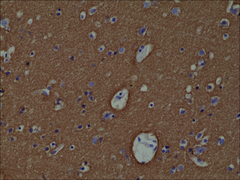 Anti-Syntaxin-1A antibody, Rabbit monoclonal recombinant, expressed in HEK 293 cells, clone RM367, purified immunoglobulin