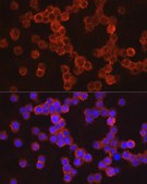 Anti-IL11RA Antibody, clone 10Z3S9, Rabbit Monoclonal