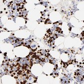 Anti-S100A12 antibody produced in rabbit Prestige Antibodies® Powered by Atlas Antibodies, affinity isolated antibody, buffered aqueous glycerol solution