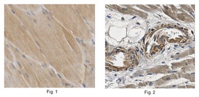 Anti-VEGF-B Antibody 1&#160;mg/mL, from rabbit