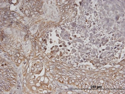 Monoclonal Anti-ERBB3 antibody produced in mouse clone 2E9, purified immunoglobulin, buffered aqueous solution