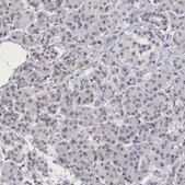 Anti-MORC2 antibody produced in rabbit Prestige Antibodies® Powered by Atlas Antibodies, affinity isolated antibody, buffered aqueous glycerol solution