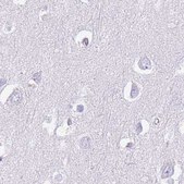 Anti-IMPG1 antibody produced in rabbit Prestige Antibodies® Powered by Atlas Antibodies, affinity isolated antibody