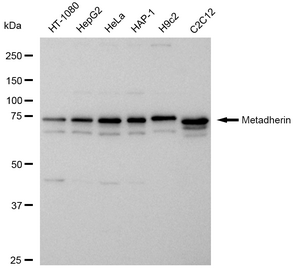 Anti Metadherin Antibody, clone 24GB455, Rabbit Monoclonal clone 24GB455, recombinant rabbit monoclonal, expressed in HEK293 cells