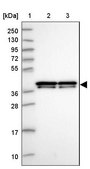 Anti-HNRNPAB antibody produced in rabbit Prestige Antibodies® Powered by Atlas Antibodies, affinity isolated antibody, buffered aqueous glycerol solution