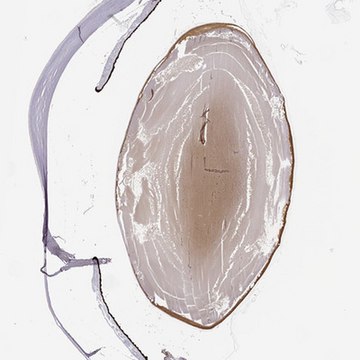 Anti-CRYBB3 antibody produced in rabbit Prestige Antibodies&#174; Powered by Atlas Antibodies, affinity isolated antibody, buffered aqueous glycerol solution