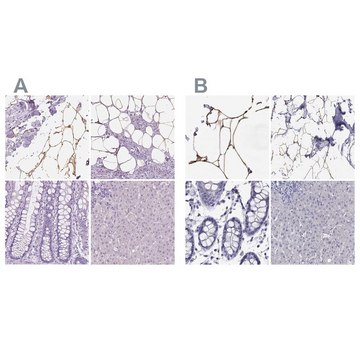 Anti-PLIN4 antibody produced in rabbit Prestige Antibodies&#174; Powered by Atlas Antibodies, affinity isolated antibody, buffered aqueous glycerol solution