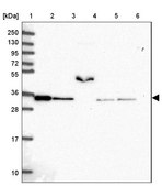 Anti-NAPA antibody produced in rabbit Prestige Antibodies® Powered by Atlas Antibodies, affinity isolated antibody, buffered aqueous glycerol solution