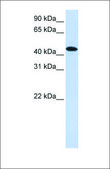Anti-MKNK2 antibody produced in rabbit affinity isolated antibody