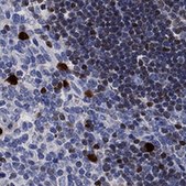 Anti-SATB1 antibody produced in rabbit Prestige Antibodies® Powered by Atlas Antibodies, affinity isolated antibody, buffered aqueous glycerol solution