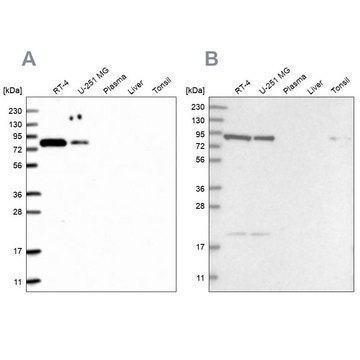 Anti-CHML antibody produced in rabbit Prestige Antibodies&#174; Powered by Atlas Antibodies, affinity isolated antibody