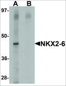 Anti-NKX2-6 antibody produced in rabbit affinity isolated antibody