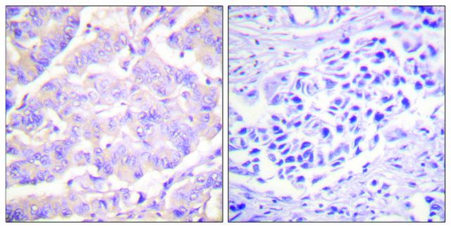 Anti-C-PLA2 antibody produced in rabbit affinity isolated antibody